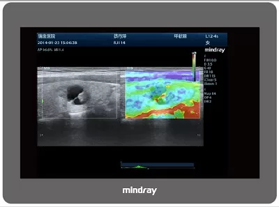 Capture_paint MINDRAY M9