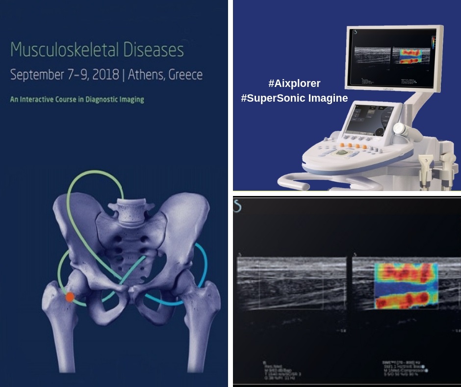 ELASTOGRAPHY