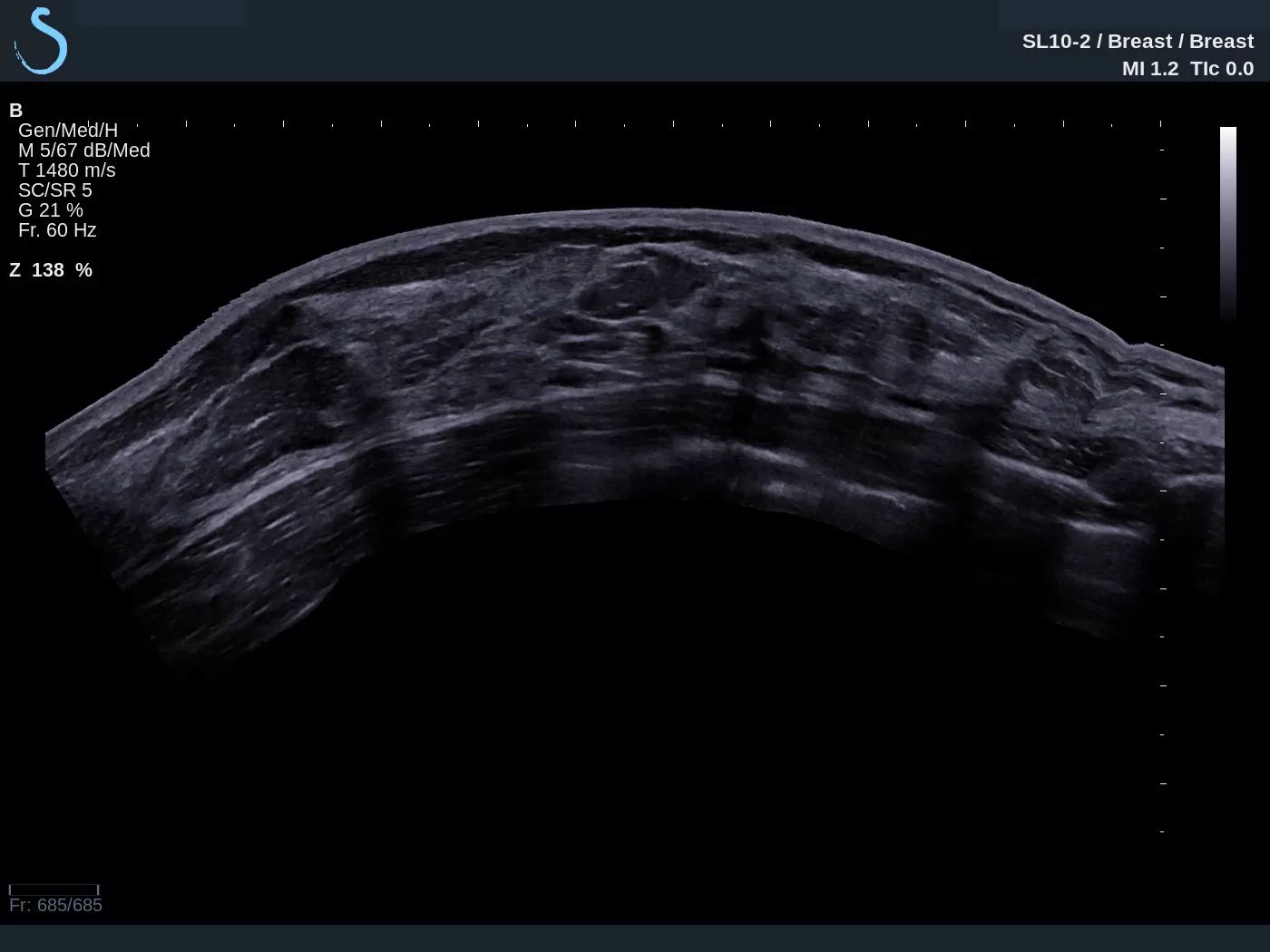 AIXPLORER ULTIMATE PANORAMIC BREAST AIXPLORER