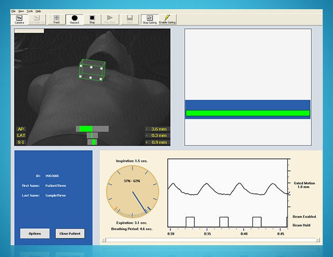 RPM Respiratory Gating System - PAPAPOSTOLOU