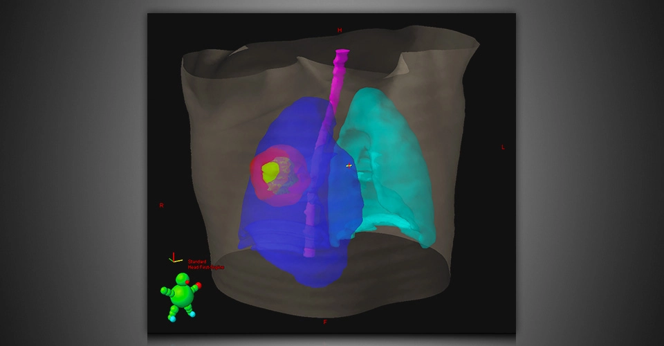 ECLIPSE™- Σύστημα Σχεδιασμού Θεραπείας