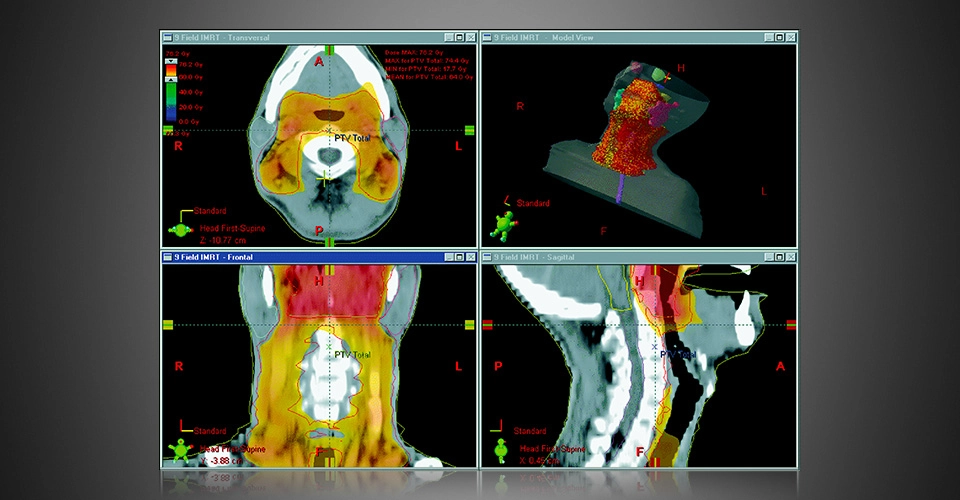 ECLIPSE™- Σύστημα Σχεδιασμού Θεραπείας