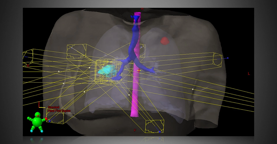 ECLIPSE™- Σύστημα Σχεδιασμού Θεραπείας