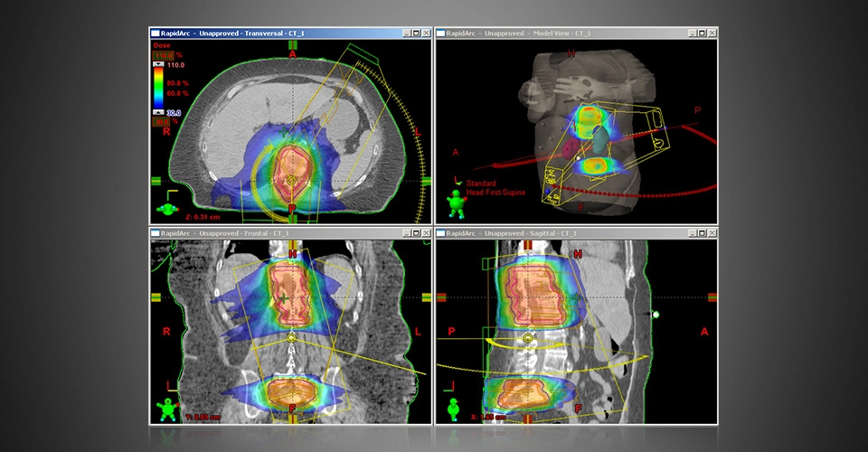 ECLIPSE™- Σύστημα Σχεδιασμού Θεραπείας