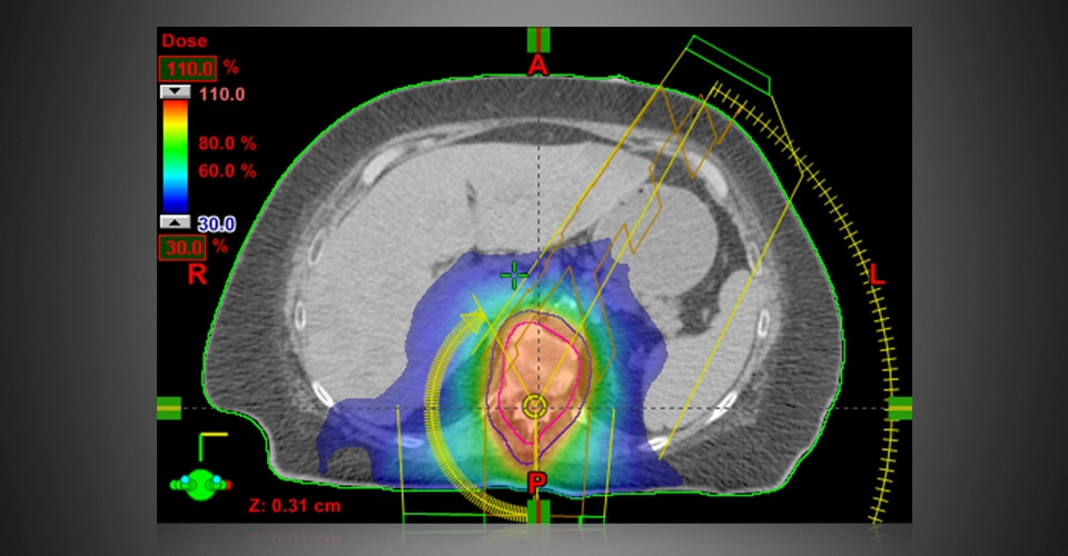ECLIPSE™- Σύστημα Σχεδιασμού Θεραπείας
