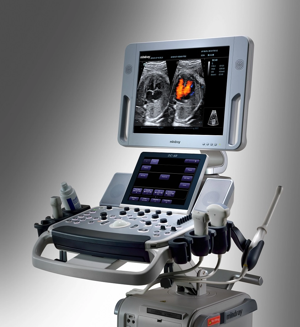 Υπέρηχος Mindray DC-60