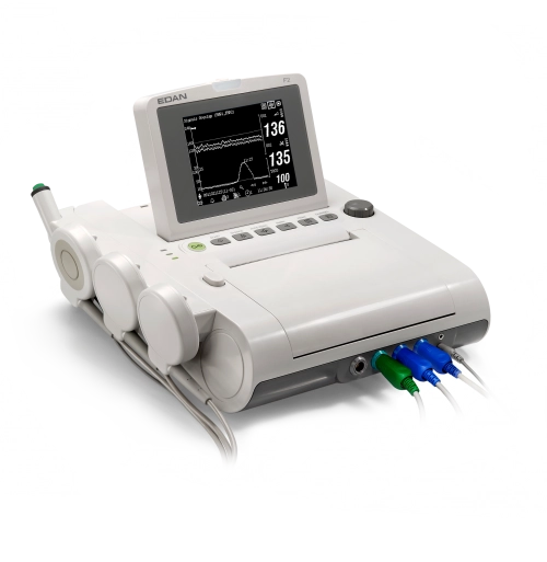 F2, Καρδιοτοκογράφος σύγχρονης τεχνολογίας