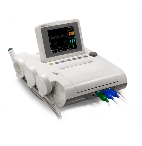 F3, Καρδιοτοκογράφος σύγχρονης τεχνολογίας