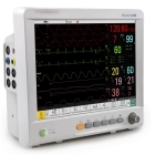 ΙΜ80, Μόνιτορ Παρακολούθησης Ζωτικών Λειτουργιών