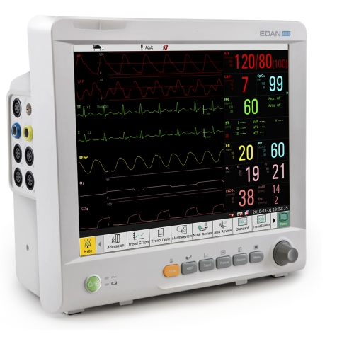 ΙΜ80, Μόνιτορ Παρακολούθησης Ζωτικών Λειτουργιών