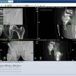 ARIA – Δίκτυο Μεταφοράς και Διαχείρισης Δεδομένων και Εικόνων