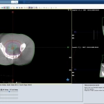 ARIA – Δίκτυο Μεταφοράς και Διαχείρισης Δεδομένων και Εικόνων