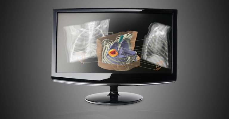 Radiotherapy Software