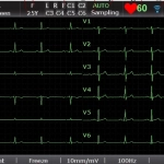 ΗΛΕΚΤΡΟΚΑΡΔΙΟΓΡΑΦΟΣ SE-601B/C
