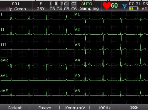 ΗΛΕΚΤΡΟΚΑΡΔΙΟΓΡΑΦΟΣ SE-601B/C