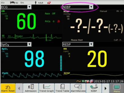 ΙΜ80, Μόνιτορ Παρακολούθησης Ζωτικών Λειτουργιών