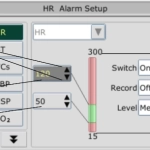 ΙΜ80, Μόνιτορ Παρακολούθησης Ζωτικών Λειτουργιών