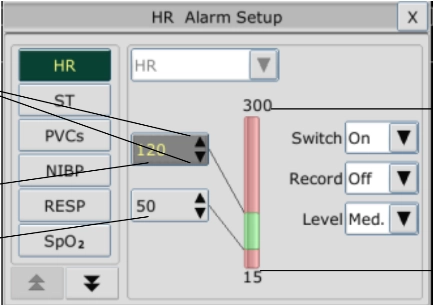 ΙΜ80, Μόνιτορ Παρακολούθησης Ζωτικών Λειτουργιών