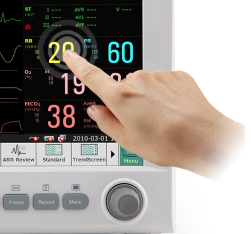 ΙΜ80, Μόνιτορ Παρακολούθησης Ζωτικών Λειτουργιών