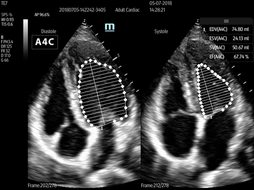 υπερηχογράφος TE7