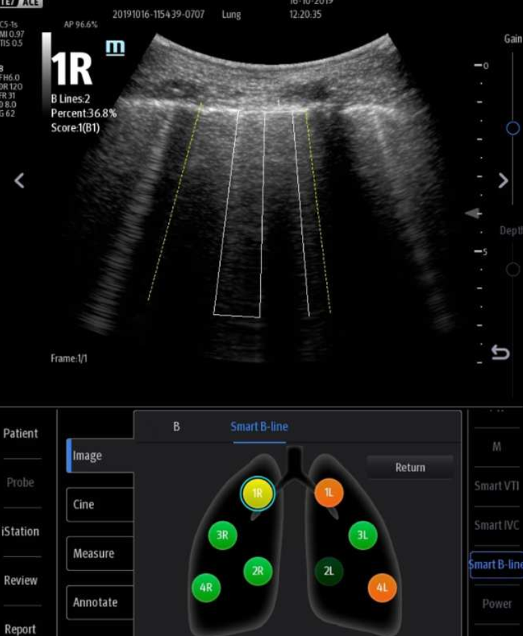 υπερηχογράφος TE7 ace