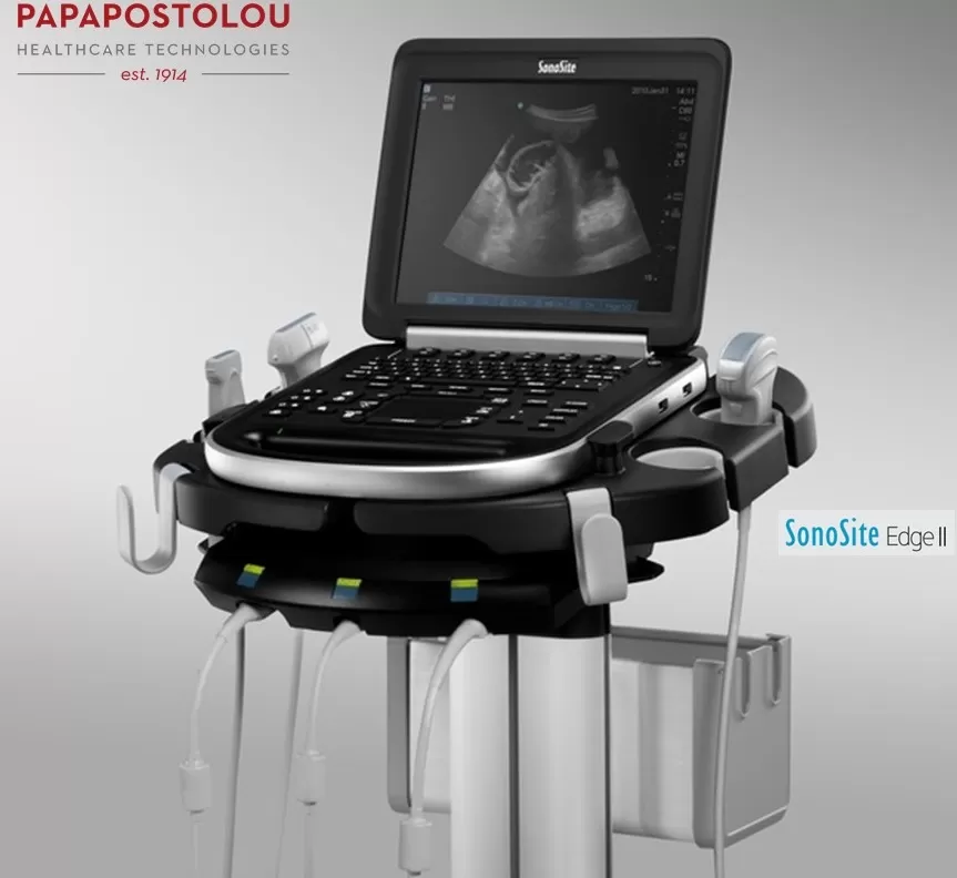 Edge II logos Fb_ προνοσοκομειακή φροντίδα, υπέρηχοι, φορητά συστήματα υπερηχοτμογραφίας, υπερηχογράφοι, υπερηχοτμογραφία, sonosite, sonoscape
