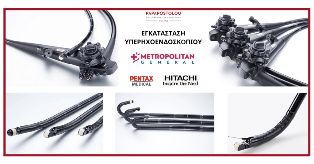 Εγκατάσταση υπερηχοενδοσκοπίου EUS J10, του οίκου PENTAX – HITACHI, στο METROPOLITAN GENERAL