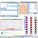 Ηλεκτροεγκεφαλογράφος TRUSCAN EEG