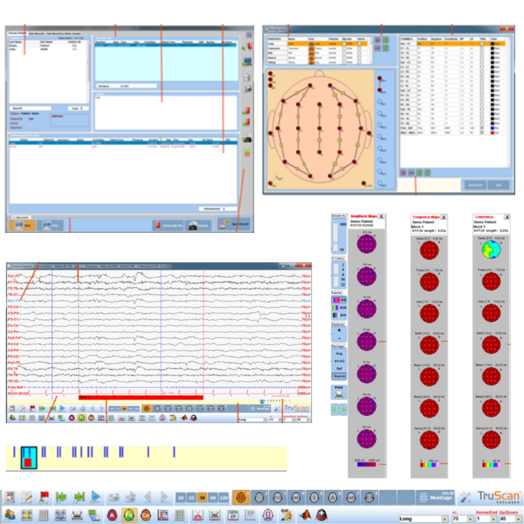 Ηλεκτροεγκεφαλογράφος TRUSCAN EEG