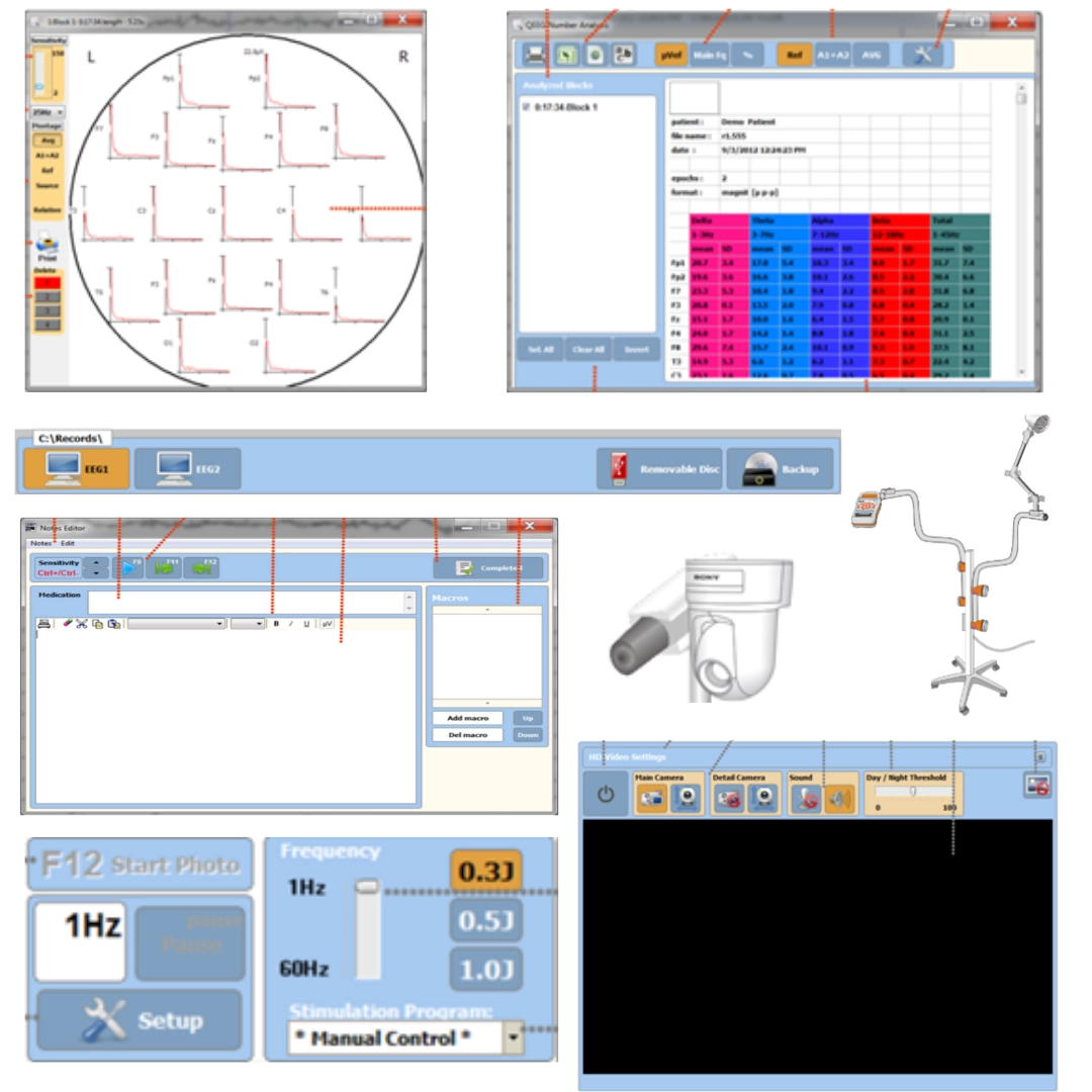 Ηλεκτροεγκεφαλογράφος TRUSCAN EEG