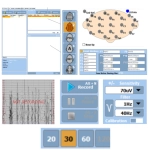 Ηλεκτροεγκεφαλογράφος TRUSCAN EEG