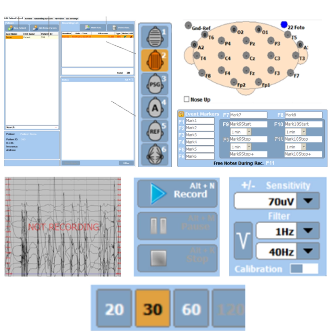 Ηλεκτροεγκεφαλογράφος TRUSCAN EEG
