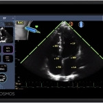 Φορητός Υπέρηχος χειρός Τablet Kosmos με τεχνητή νοημοσύνη