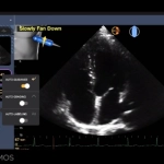 Φορητός Υπέρηχος χειρός Τablet Kosmos με τεχνητή νοημοσύνη