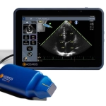 Φορητός Υπέρηχος χειρός Τablet Kosmos με τεχνητή νοημοσύνη