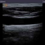 Φορητός Υπέρηχος χειρός Τablet Kosmos με τεχνητή νοημοσύνη