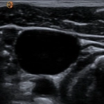 Φορητός Υπέρηχος χειρός Τablet Kosmos με τεχνητή νοημοσύνη