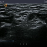 Φορητός Υπέρηχος χειρός Τablet Kosmos με τεχνητή νοημοσύνη