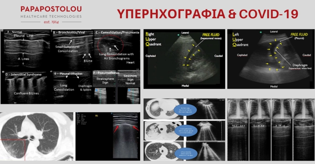 Υπερηχογραφία & Covid-19
