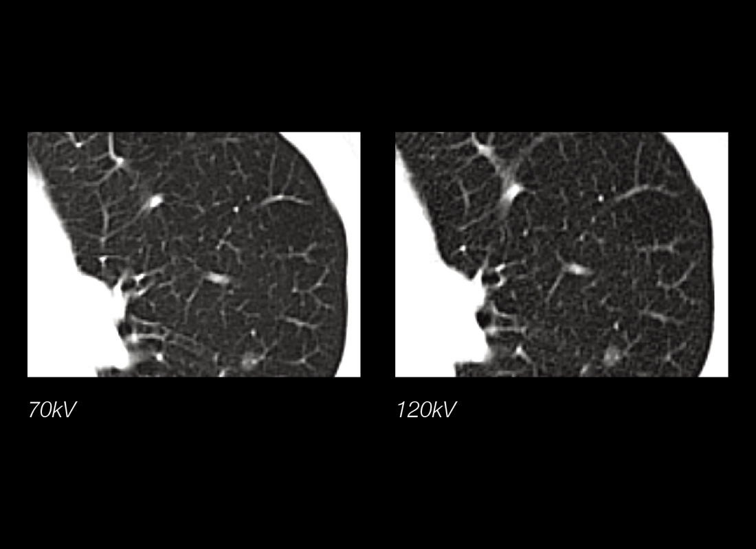 uCT 528 40 / 80 slice