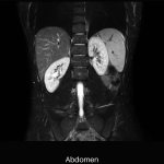 uMR 570 | 70cm Wide-Bore 1.5T MR