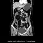 uCT 530 | 20 / 40 Slice