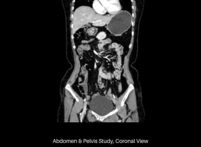 uCT 530 | 20 / 40 Slice