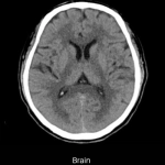 uCT 530 | 20 / 40 Slice