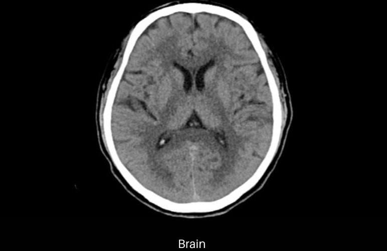 uCT 530 | 20 / 40 Slice