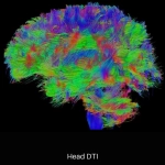 uMR OMEGA™ | 75-cm Ultra-Wide-Bore 3.0T