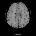 uMR OMEGA™ | 75-cm Ultra-Wide-Bore 3.0T