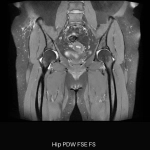 uMR OMEGA™ | 75-cm Ultra-Wide-Bore 3.0T