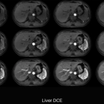 uMR 790 | High-Performance 3.0T MR