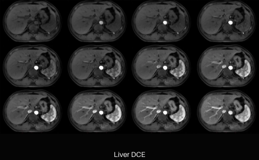 uMR 790 | High-Performance 3.0T MR